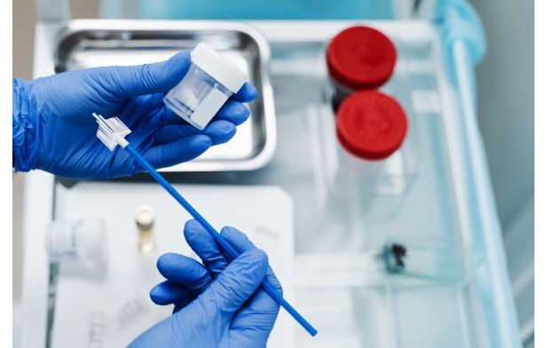 What are the three rules for preventing cervical cancer?