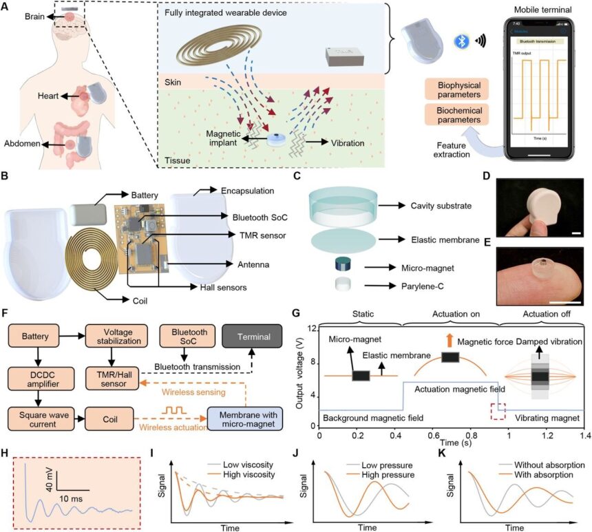 Tiny magnetic implants enable wireless health monitoring when paired with wearable device