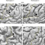 Brain-machine interface device predicts internal speech in second patient