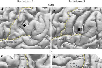 Brain-machine interface device predicts internal speech in second patient