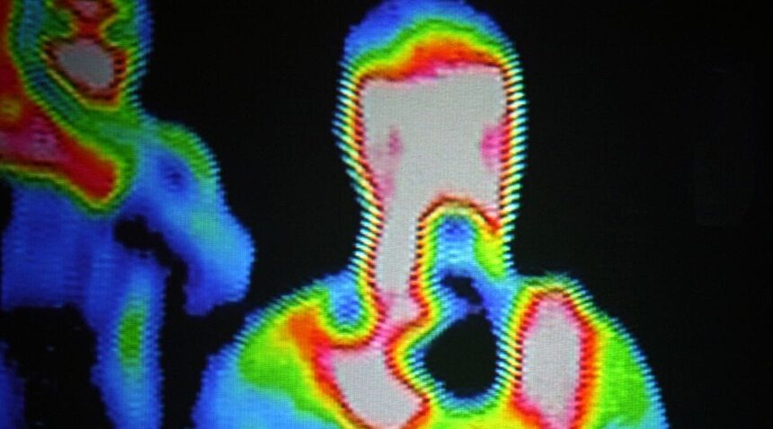 Engineers develop technique that enhances thermal imaging and infrared thermography for police, medical and military use