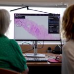 UK hospitals begin live trial of prostate cancer-detecting AI