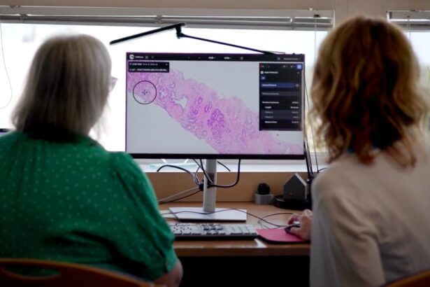 UK hospitals begin live trial of prostate cancer-detecting AI