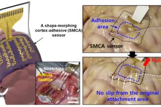 Shape-morphing brain sensor adheres to curved surfaces for ultrasound neurostimulation