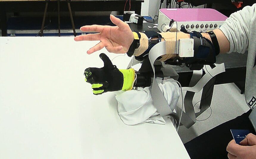 New soft prosthetic hand offers natural bionic interfacing