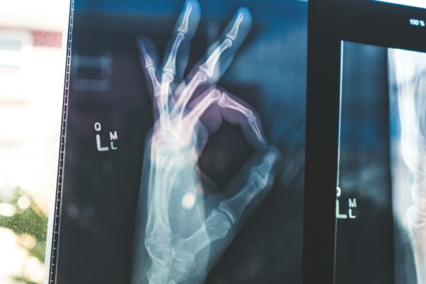 Google's open MedGemma AI models could transform healthcare